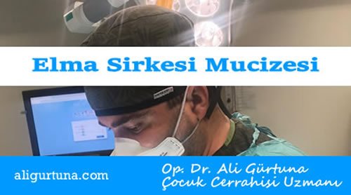 Elma sirkesinin mucizevi faydaları nelerdir Elma sirkesinin mucizevi faydaları nelerdir